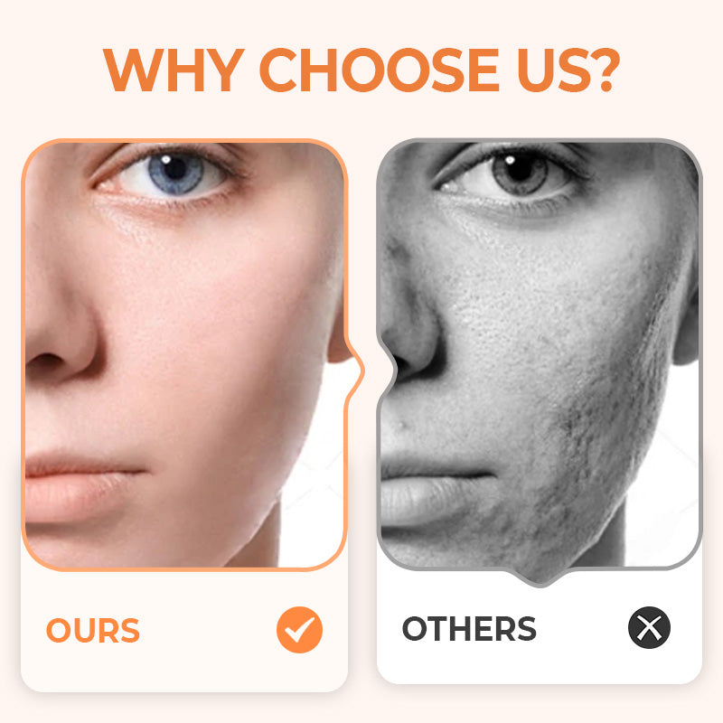 💦✨ Reusable waterproof silicone scar patch! Making scars invisible is not a dream ✨💦! - Image 3