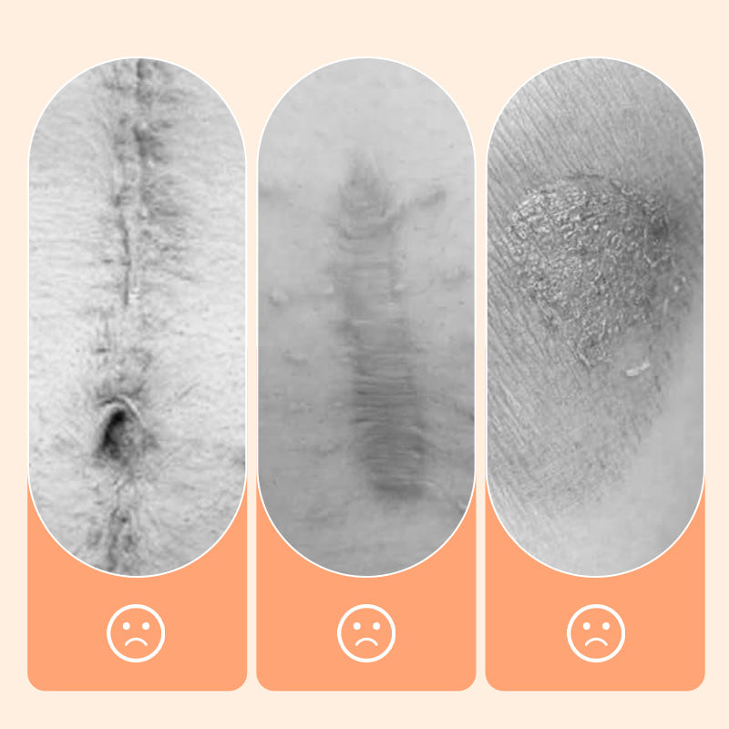 💦✨ Reusable waterproof silicone scar patch! Making scars invisible is not a dream ✨💦! - Image 4